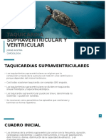 Taquicardia Supraventricular y Ventricular