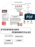 Mapa Creativo de Las Enfermedades Periodontales