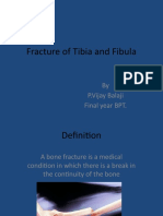 Fracture of Tibia and Fibula