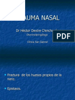 Trauma Nasal