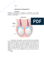 Methods of Contraception 1. Permanent Contraception