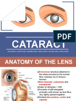 CATARACT