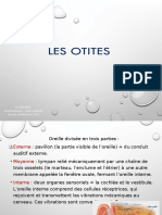 OTITES