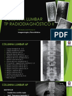 Columna Lumbar Radiologia