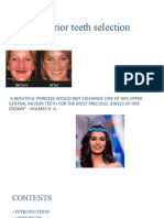 Anterior Teeth Selection