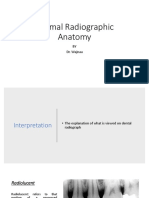 Normal Radiographic Anatomy: BY Dr. Wajnaa