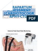 Intrapartum Assessment