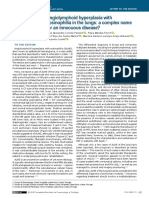 Angiolymphoid Hyperplasia With Eosinophilia in The Lungs: A Complex Name For An Innocuous Disease?