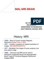 Normal Mri Brain - Dr. Piyush Ojha