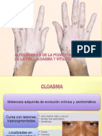 Vitiligo Cloasma