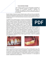 Placa Dentobacteriana