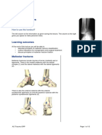 ORP - Handout - English - Malleolar Fractures