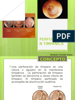 Perforacion Timpanica