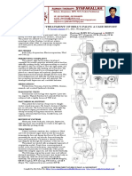 Acupuncture Treatment of Bell - S Palsy