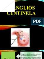 Ganglios Centinela