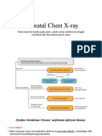 Neonatal Chest X-Ray