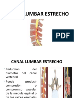 Canal Lumbar Estrecho