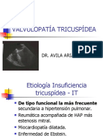 Valvulopatia Tricuspídea