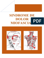 Sindrome Miofascial