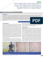 60 TH Male Spermatic Cord Hydrocele