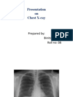 Chest Xray 2