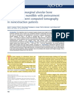 Evaluation of Marginal Alveolar Bone in The Anterior Mandible With Pretreatment and Posttreatment Computed Tomography in Nonextraction Patients