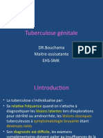 Tuberculose Génitale