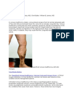 Venous Insufficiency