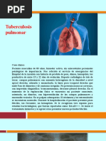 Tuberculosis