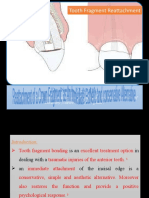 Tooth Fragment Reattachment: Dr. Nuha El-Kadiki