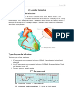 What Is Acute Myocardial Infarction?