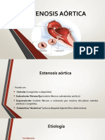 Estenosis Aórtica