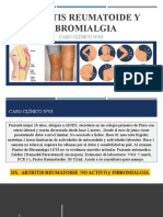 Artritis Reumatoide y Fibromialgia