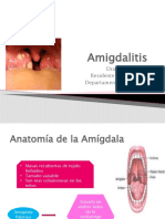 Amigdalitis