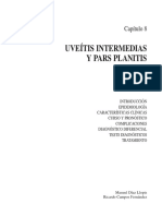 Uveítis Intermedias y Pars Planitis