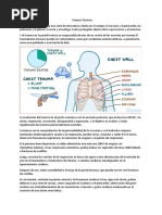 Trauma Toracico