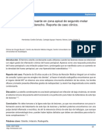 Osteitis Condensante Caso Clínico PDF