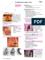 Gyne - Benign Lesions