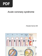 Acute Coronary Syndrome: Patsadee Nachom MD