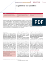 Diagnosis and Management of Oral Candidosis: Practice