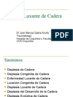 Displasia Luxante de Caderas