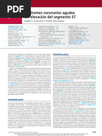 Síndromes Coronarios Agudos Sin Elevación Del Segmento ST: Robert P. Giugliano Y Eugene Braunwald