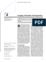 Imaging of Shoulder Arthroplasties: Cristy Gustas-French Jonelle Petscavage-Thomas Stephanie A. Bernard