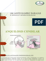 Anquilosis Condilar y Neoplasias de Atm