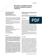 Multiple Traumatic Injury To Maxillary Incisors in An Adolescent Female: Treatment Outcome With Two Years Follow-Up