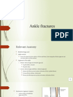 Ankle Fractures: Dr. T. Vikram