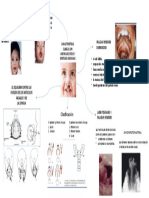 Caracteristicas LPH