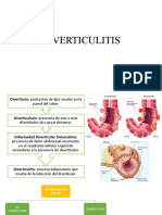 DIVERTICULITIS