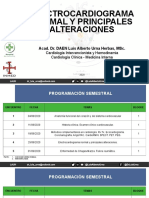 EKG Normal y Principales Alteraciones PDF