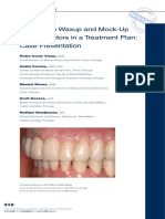 11 - Soft Tissue Waxup and Mock-Up and Key Factors in